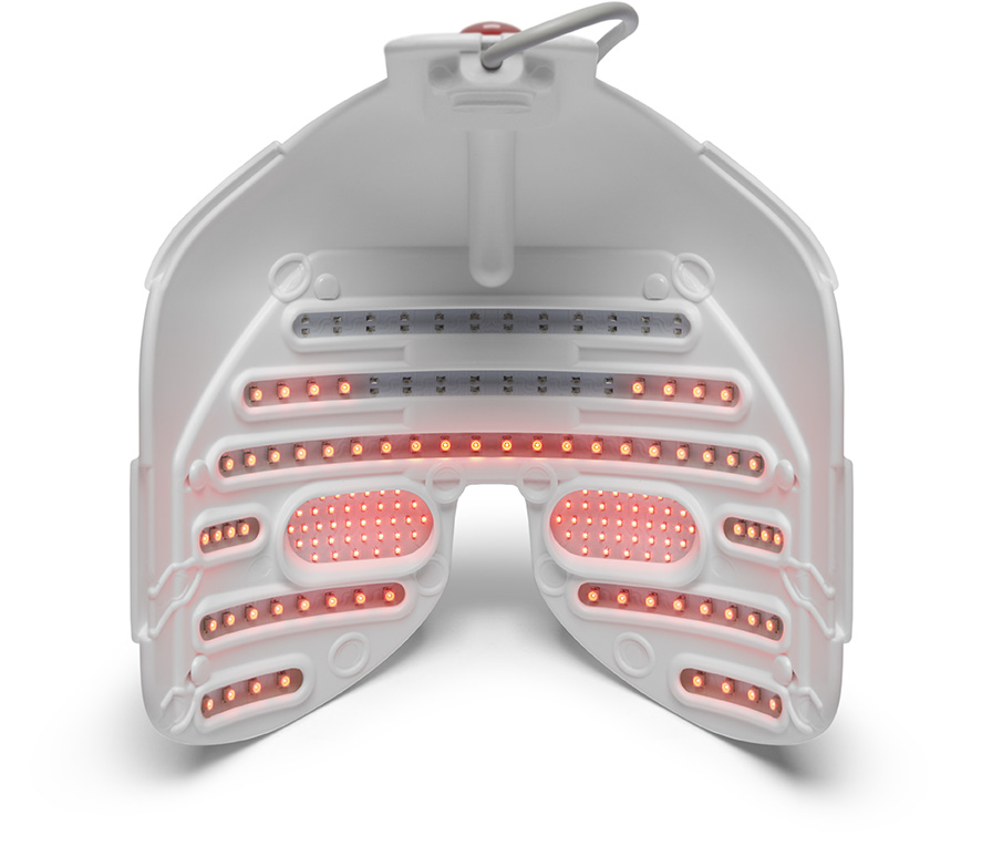 Máscara LLLT para fotobiomodulación en el tratamiento ocular de ojo seco.